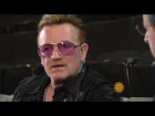 U2's Bono on glaucoma