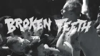 Broken Teeth - Riot Of The Mind (Official Video)