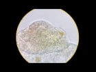 Дефекация инфузории Frontonia. 1350х / Defecation of the ciliate Frontonia. 1350х