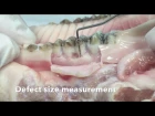Guided tissue regeneration GTR (Pig Jaw) - performed by residents DK Perio