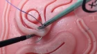 18.102MUL Laparoscopic Intracorporeal Suturing: Fundamentals and Tips & Tricks for New Learners