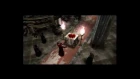 Resident Evil 4 -- Stupid MF