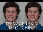 How to retouch the skin of a teenager Photoshop Tutorial - PLP # 52 by Serge Ramelli\\kj