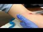 Пункция вены Видео Intravenous injection