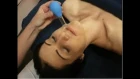 Вакуумный баночный массаж лица | омоложение лица дома