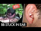 BB Stuck In Ear - Airsoft Injury | Sniper Gameplay